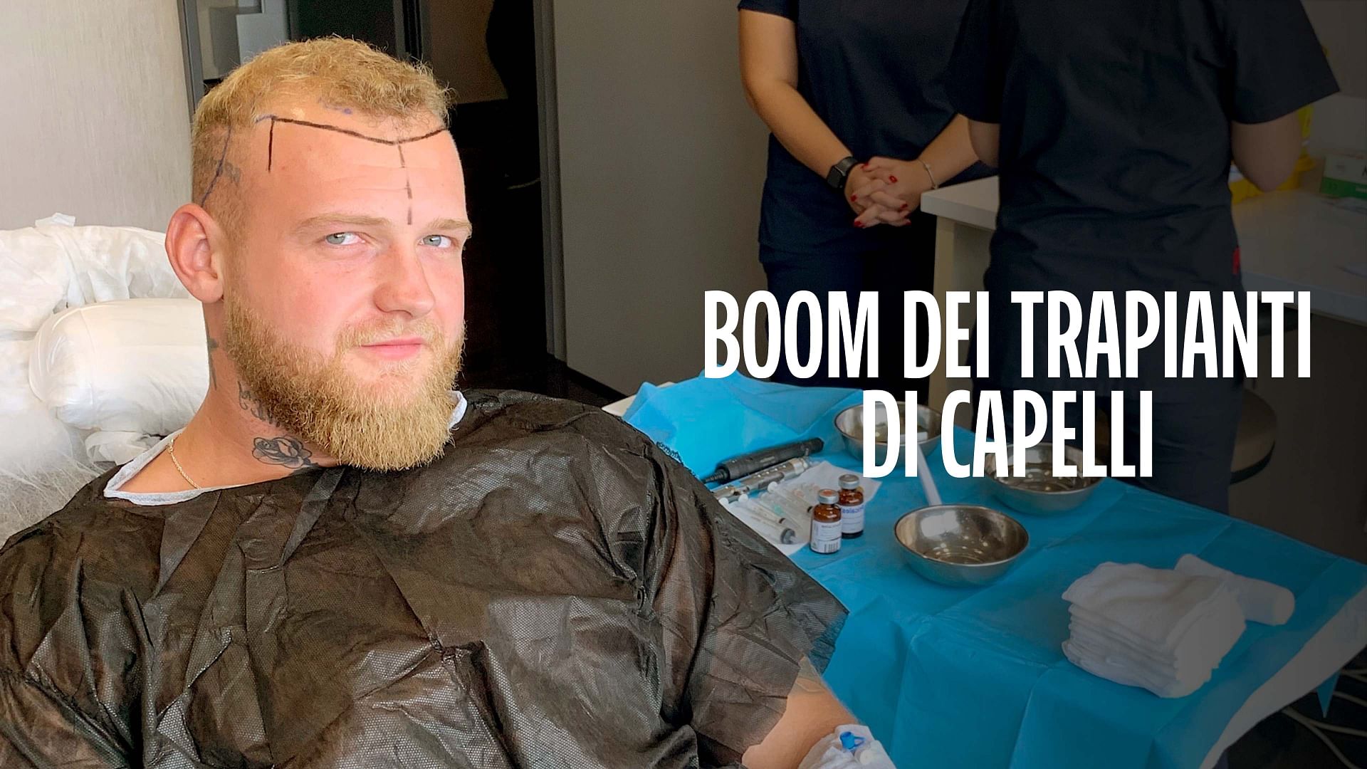 Re: sguardi sulla società - Il boom dei trapianti di capelli